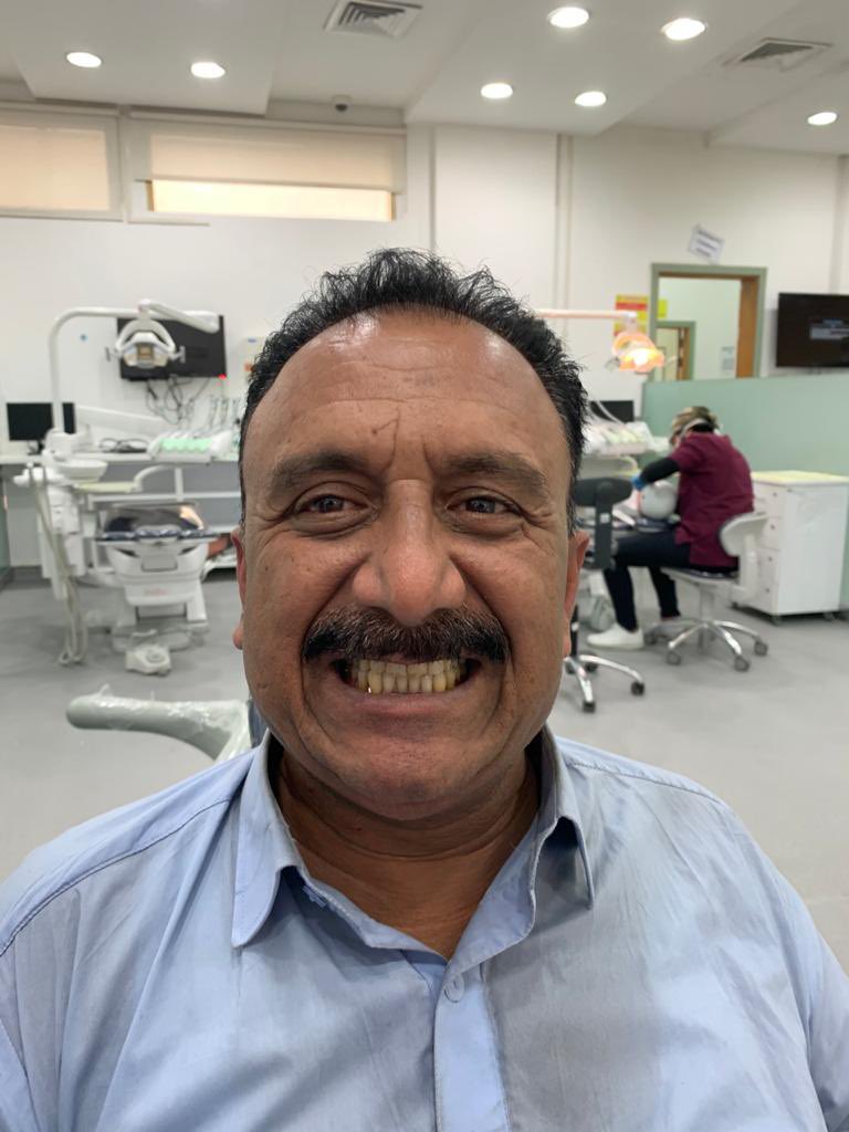 doctoryousif's tweet photo. Let’s Appreciate his new smile 😍 https://t.co/WTuY8vJtC8