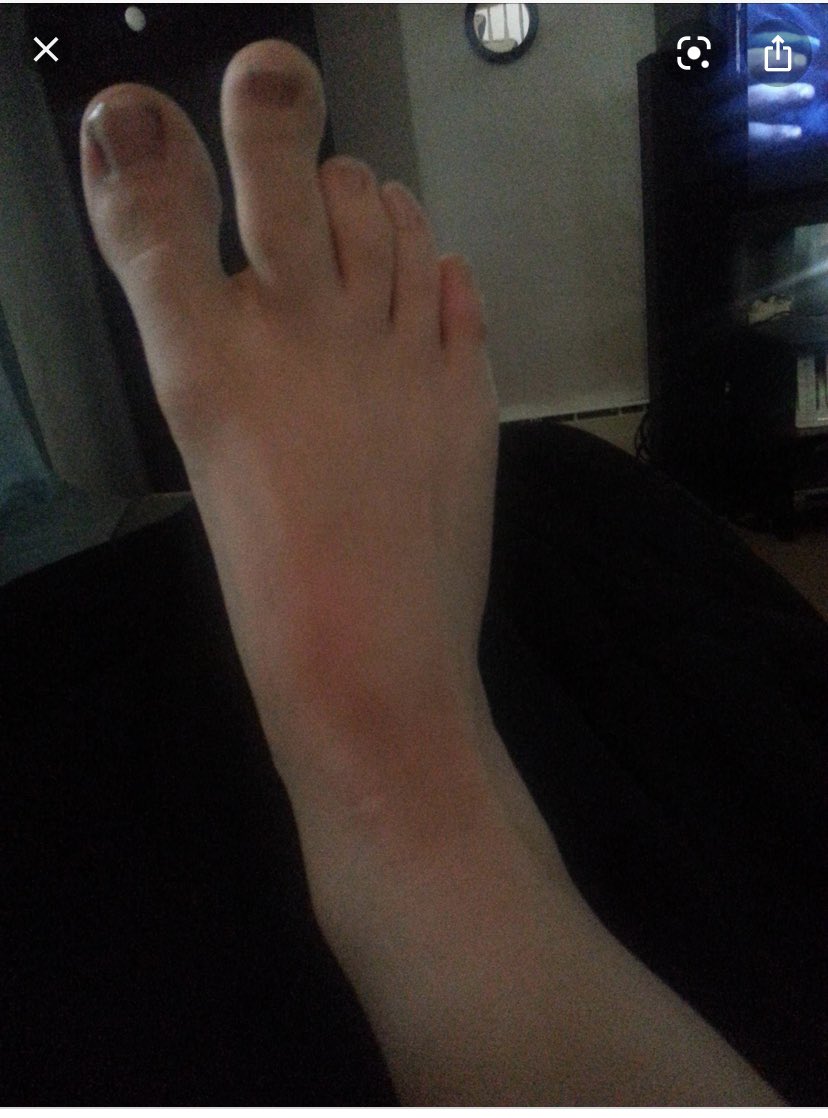 Phil Suckling tweet media