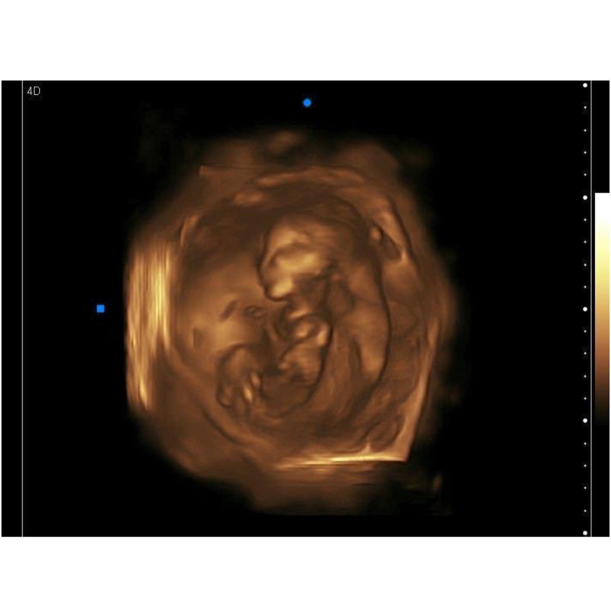 mudslutin's tweet photo. @KimKardashian I need this more then ever! Between a new baby, being laid off due to covid, &amp; a crazy car payment! Anything would help at this point. This has been one crazy year for everyone. Merry Christmas! $mudslutin #KKWHoilday https://t.co/YVnx5CkCW0