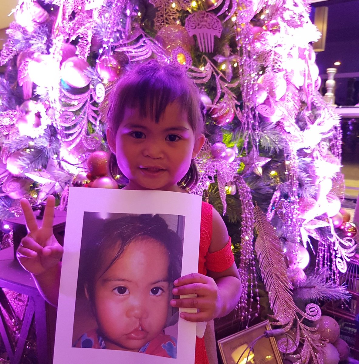 smiletrainuk's tweet photo. Here's a Christmas #TransformationTuesday for you, as we continue our #12DaysOfSmiles! β¨
Every day, 540 babies are born with a cleft. Our medical partners work tirelessly across the world, to help as many children as possible access the treatment they need. https://t.co/i0al27nhq3
