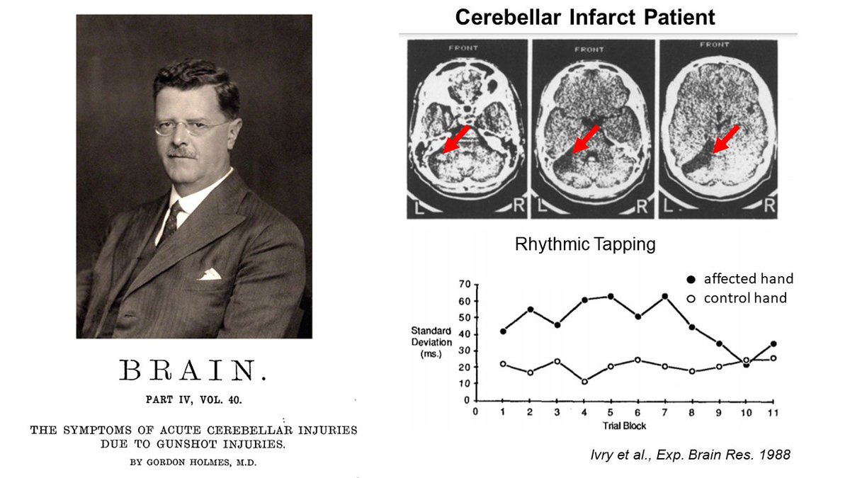 Patients with cerebellar pathology demonstrate that the cerebellum is crucial for facilitating such fine motor coordination (Holmes 1917; Ivry et al. 1988). Yet, how it orchestrates precisely timed motor responses to multimodal sensory inputs is not fully understood. 3/15