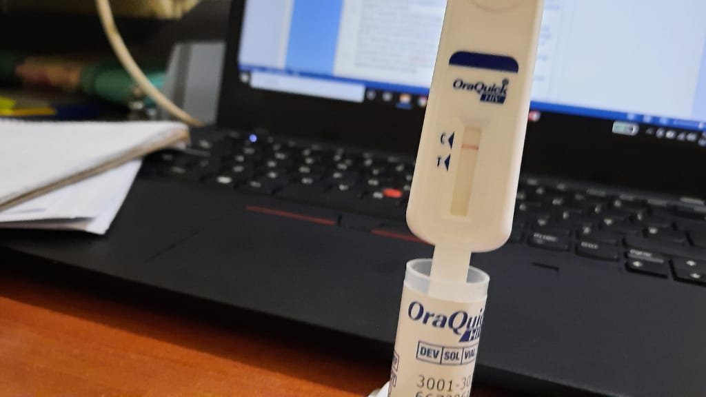 h_empowered's tweet photo. Unlike other HIV test measures, HIV virus or HIV antigen from blood, OraQuick measures the HIV antibodies in oral fluid(not Saliva). The test kit contains an oral SWAB attached to the reader, see demonstration on the picture and soberly, let's discuss it's benefits. https://t.co/PzcNUl6j2R