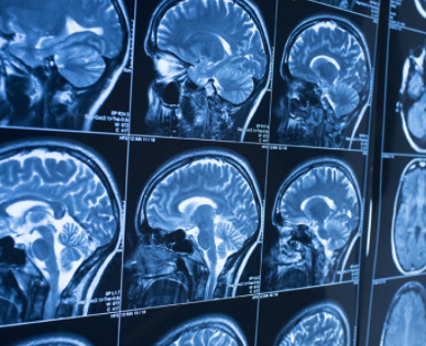 ImagingMedicine's tweet image. #Radiologists are restorative specialists that specialize in diagnosing and treating wounds and infections utilizing restorative imaging (radiology) #strategies (exams/tests) such as X-rays, #computed tomography (CT), attractive reverberation #imaging (MRI).