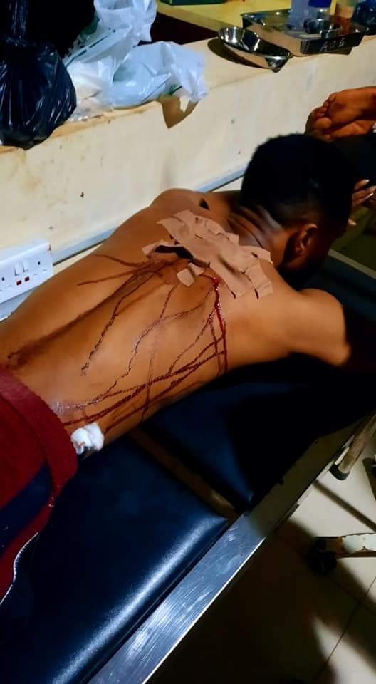dalis_white's tweet photo. A mother was shoot died, and a man was shot at Asaba yesterday night please guys let's make this go Viral #EndDeltaHawk #EndSARS https://t.co/3Adsyh2IFi