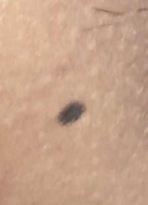 What should I name my freckle? 🤣 https://t.co/lx7BkV5rtQ<a href="/tag/sun"class="tags"><span>#sun</span></a><a href="/tag/desert"class="tags"><span>#desert</span></a>