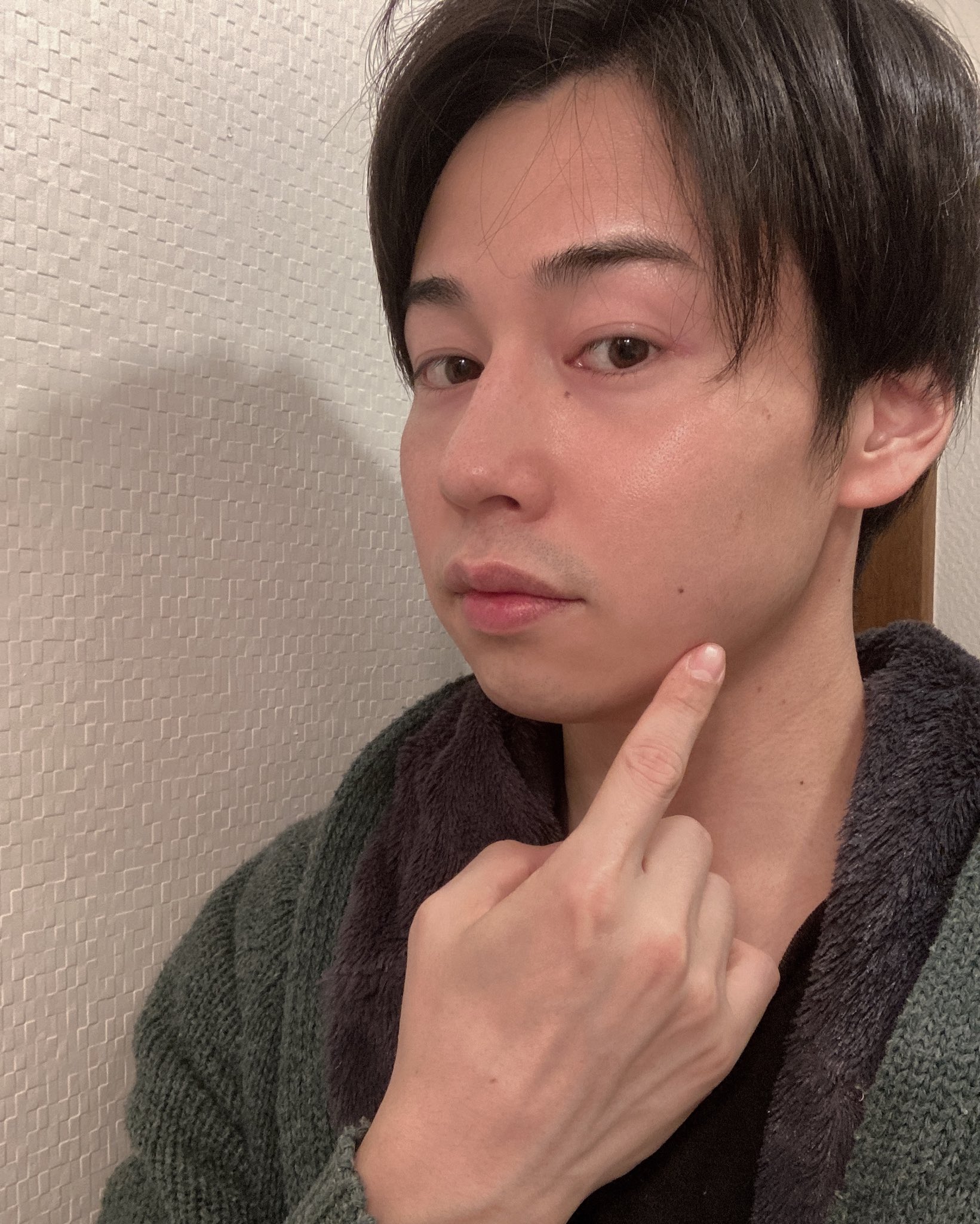 松田航輝 親知らず 抜いたんです 三本一気に抜いたんです なかなか攻めたことしたから 鬼のように腫れて 食事もろくに取れず 涙目でビフォーアフターの写真アップしようと思ったんです 結果 ほとんど腫れてません どゆこと 初体験 不安で