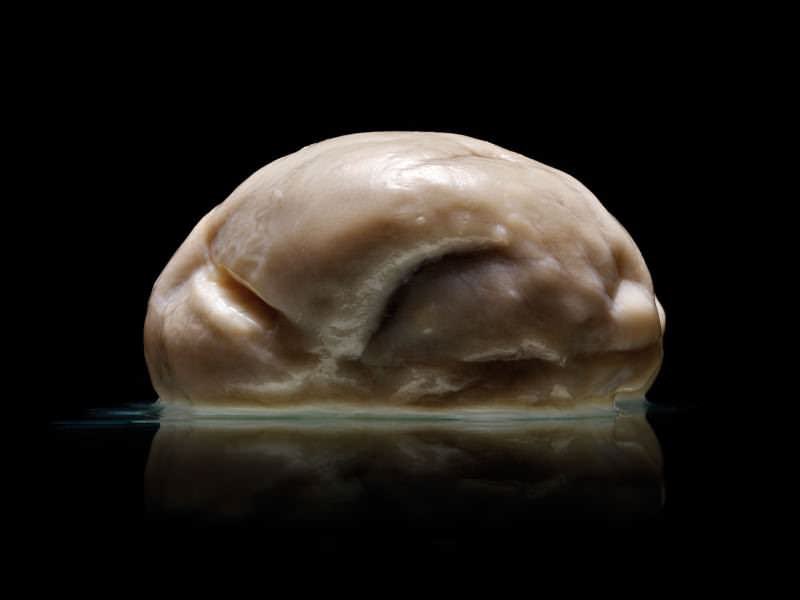 We (as well as most mammals) have folds in our brains to increase surface area for neurons. Because intelligence. Their brains just look like amala (not even slander, I love amala but it’s true)