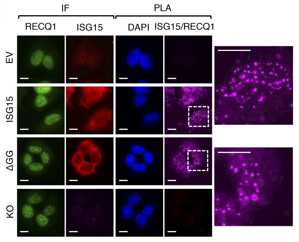 JCellBiol's tweet photo. Maria Chiara Raso, Lorenza Penengo et al. show that the ubiquitin-like molecule ISG15 accelerates replication fork progression (https://t.co/grkvkAk4mZ). From the Year in Cell Biology 2020 collection: https://t.co/eQjiOpSlNh
#cellbio2020 https://t.co/59zl6xX8Pm