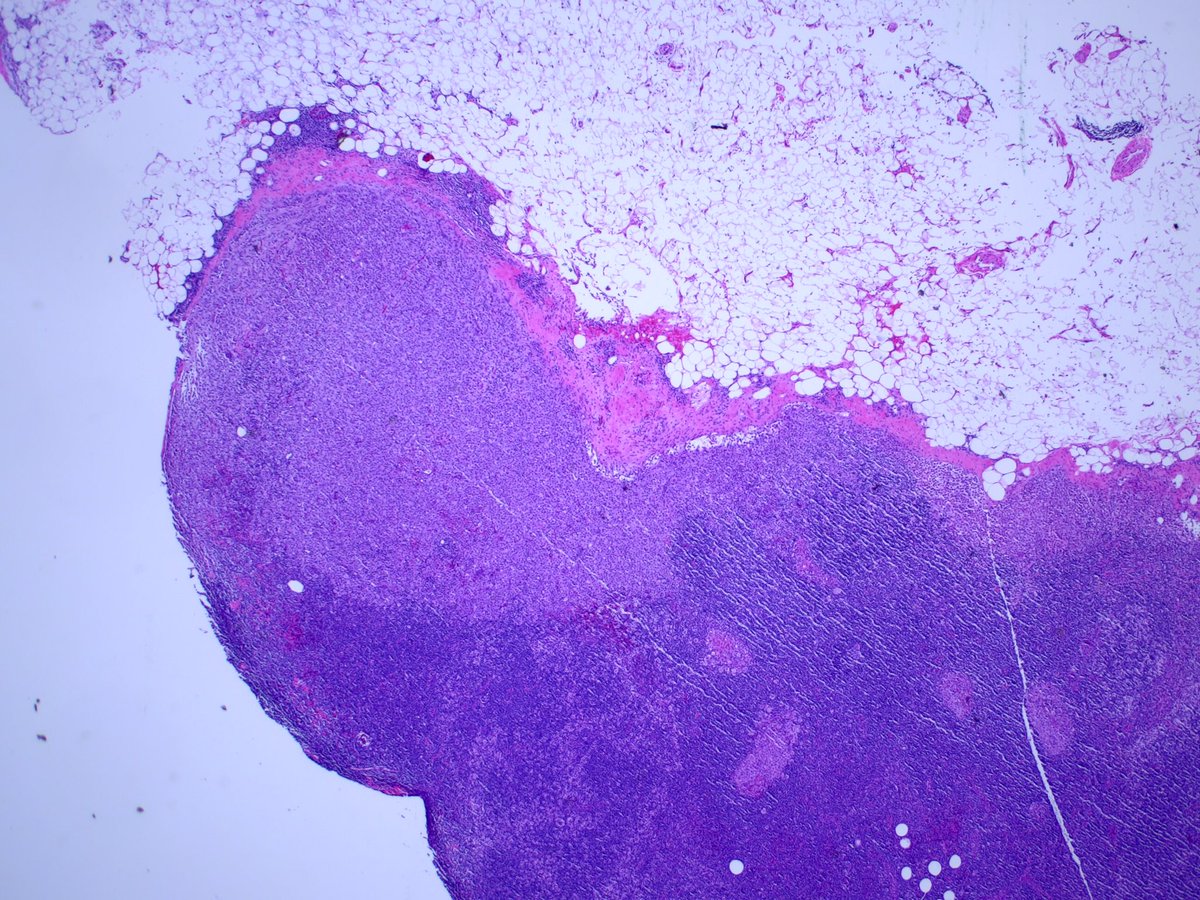 3. Corresponding permanents: