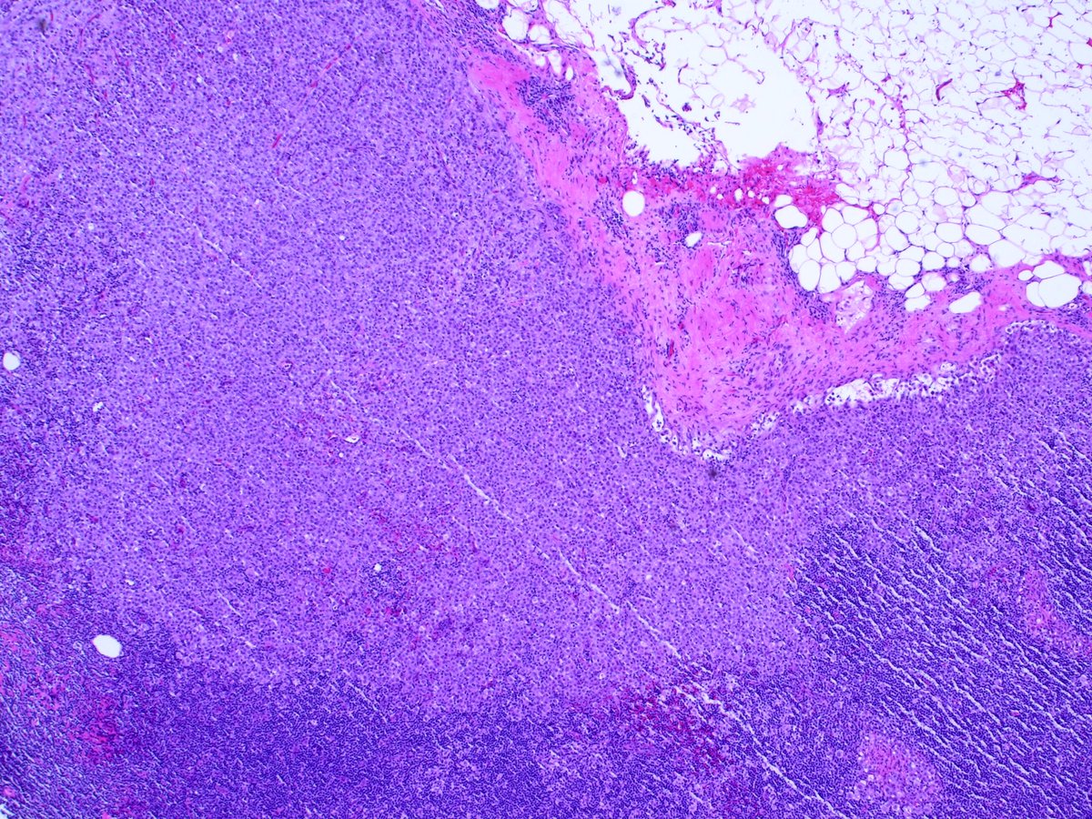 3. Corresponding permanents: