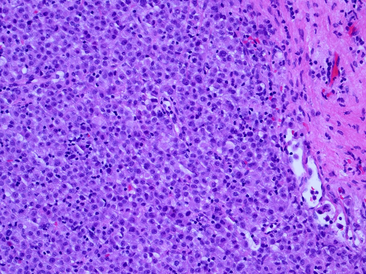 3. Corresponding permanents: