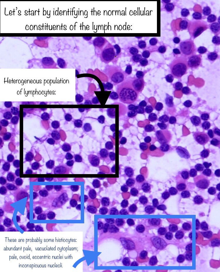 5. Let’s start by identifying the normal nodal constituents: