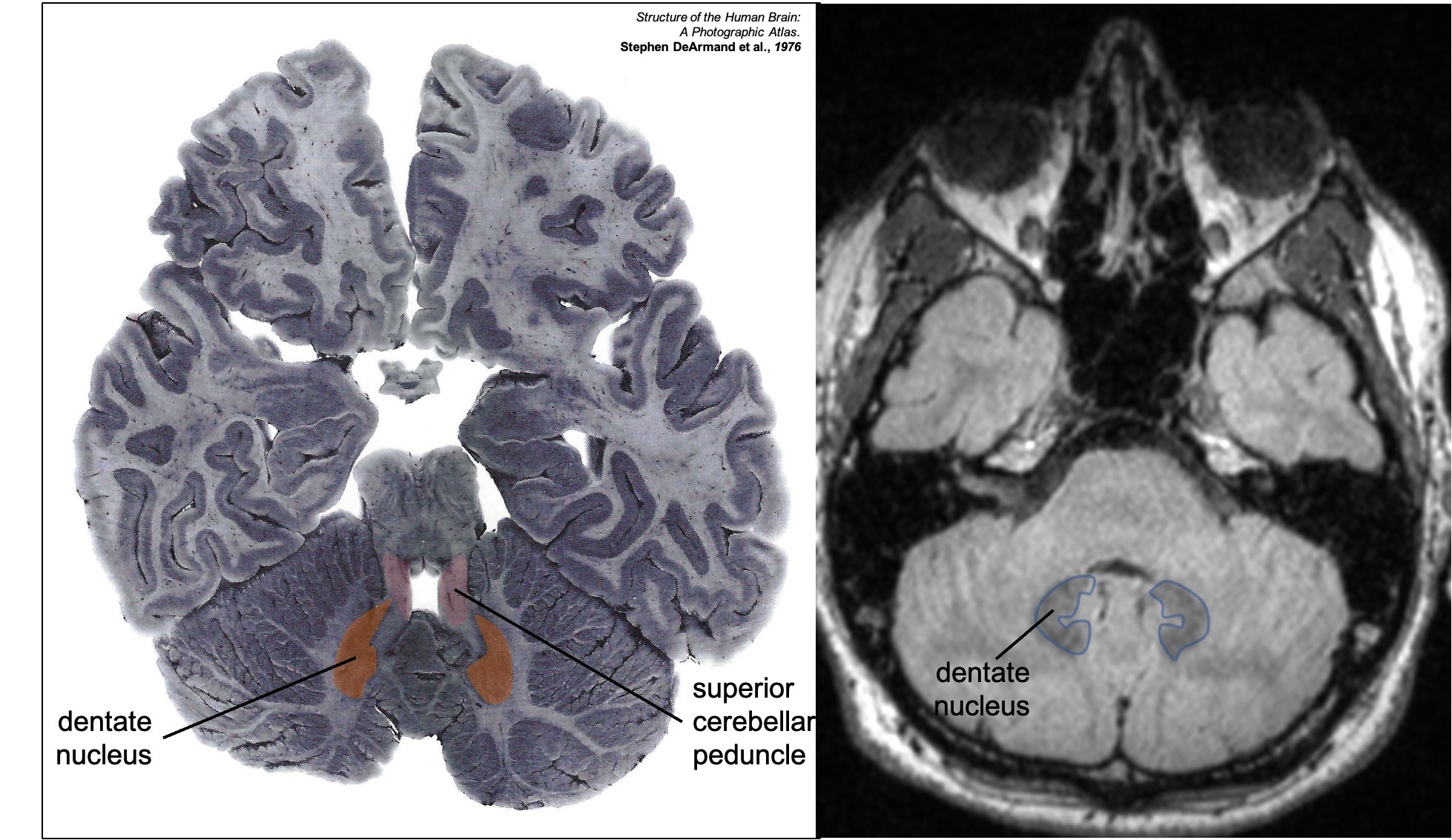 Aaron Rutman, MD on X: Aaron Rutman, MD on X: