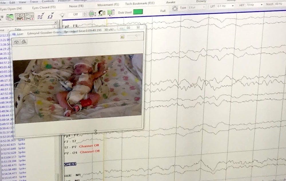 Something was wrong with Ned, and it wasn’t coming back on any of the usual tests. We spent a week in the NICU, terrified. Then months, confused. Life went on, but he just kept missing developmental milestones.