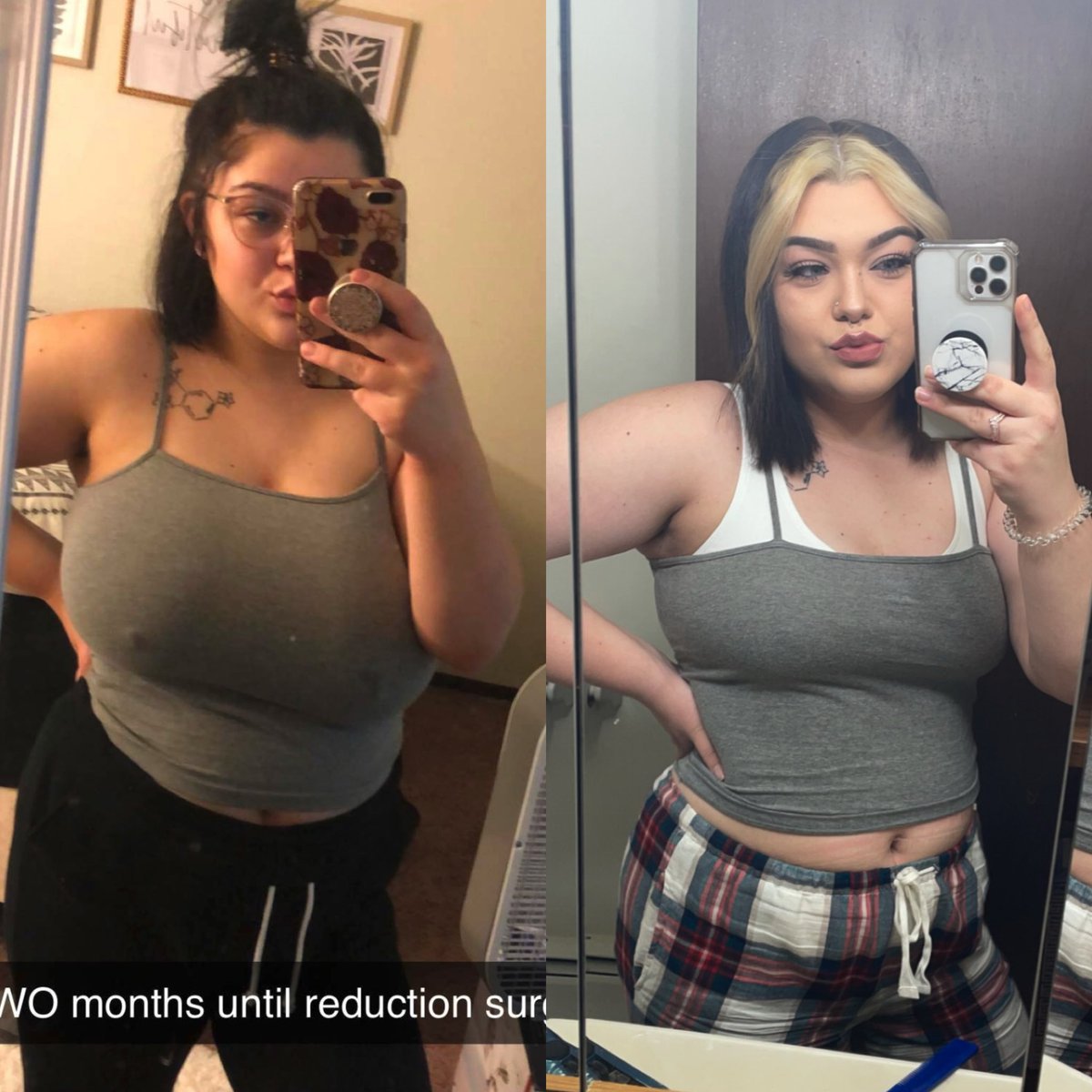 17makdaddy's tweet photo. My life is FOREVER changed. I’m SO glad I had the opportunity to experience this procedure. I’d do the process allllll over again just to feel the way I do rn https://t.co/d1AJawFML7