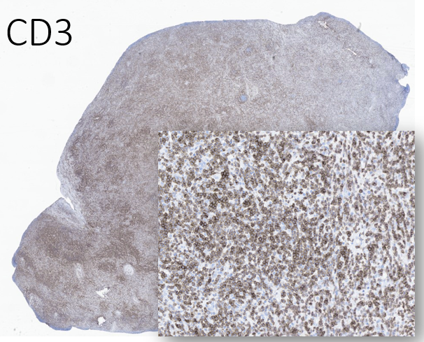13/Everything is negative. Now, just to confirm this is - in fact - a CD4+ T-cell process for those of you doubting we're ever going to get to the bottom of this...