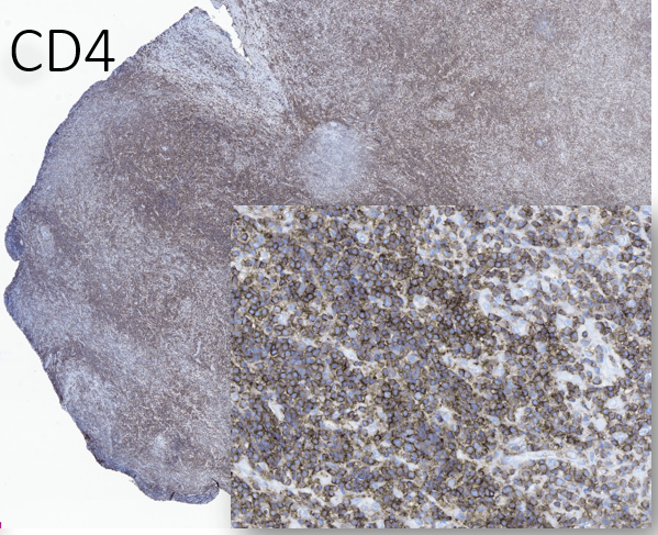 13/Everything is negative. Now, just to confirm this is - in fact - a CD4+ T-cell process for those of you doubting we're ever going to get to the bottom of this...