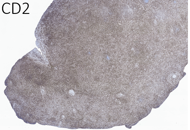 14/Other positive T-cell markers