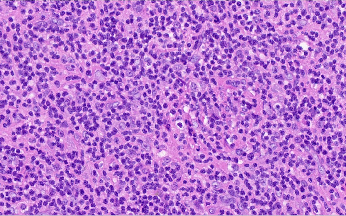 19/Anyone want to go back to the morphology?