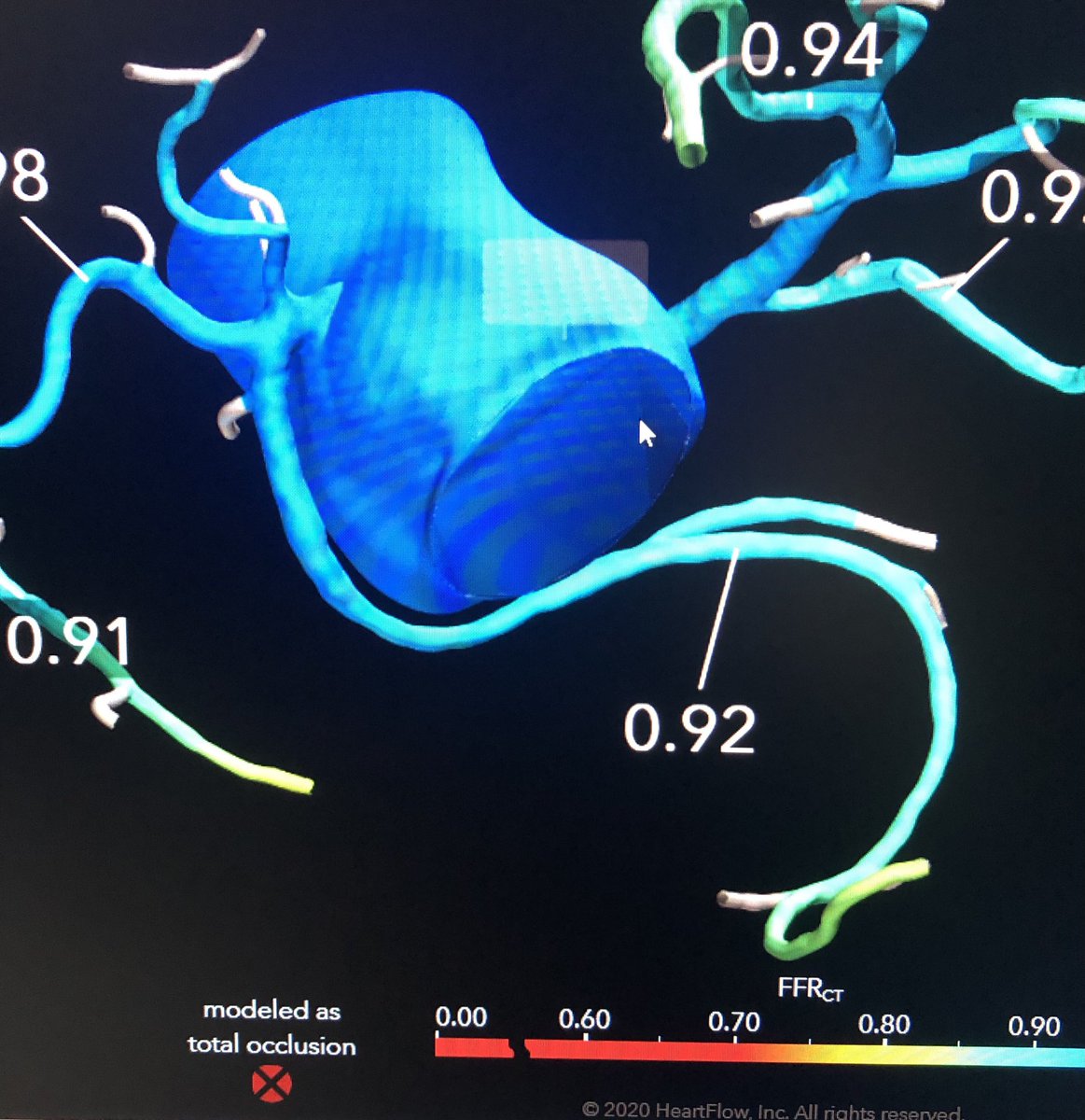 PAPOWEATHERS13's tweet image. 