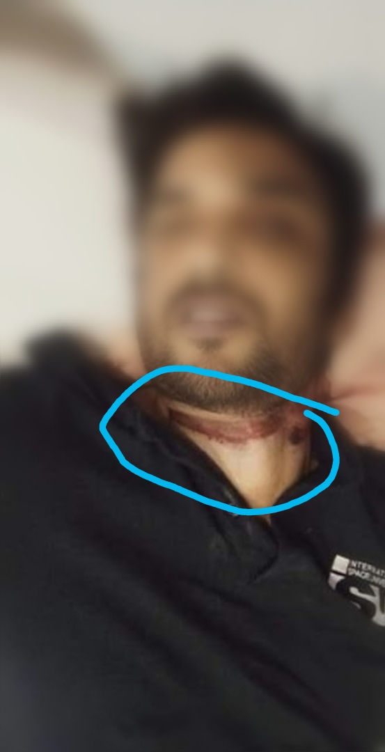 itissurendran's tweet photo. @Abishekwilsonn Bro please discuss this one also.
#VJChitra #ripchithra #BiggBossTamil4 @ThanthiTV @PTTVEnglish @sunnewstamil https://t.co/tKzHEQ7zl1