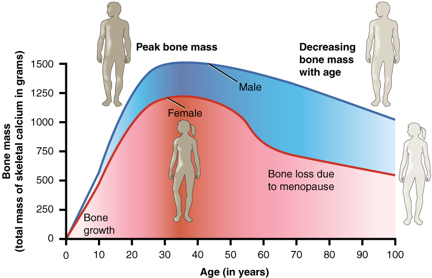 doctorneyro's tweet photo. Quizás no le dado suficiente #importancia pero ¿#sabíasque la #osteoporosis mata #4veces más #mujeres que el #cáncerdemama?
Y está relacionada con tu #menopausia.
https://t.co/1ZrIQigluL https://t.co/92YVTbEcR0