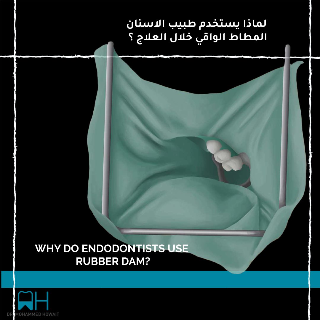 mohdhowait's tweet photo. Why do Endodontists use Ruber dam? لماذا يستخدم طبيب الاسنان العازل المطاطي ؟

#endodontics #rootcanal #savingteeth #healing  #rootcanaltreatment 
#unidents #dentalclinic #jeddah  #saudiarabia #tooth_decay #RCT #علاج_عصب #عيادات_اسنان_جده #تسوس_اسنان #جذور_اسنان https://t.co/F1mZLaCFDM