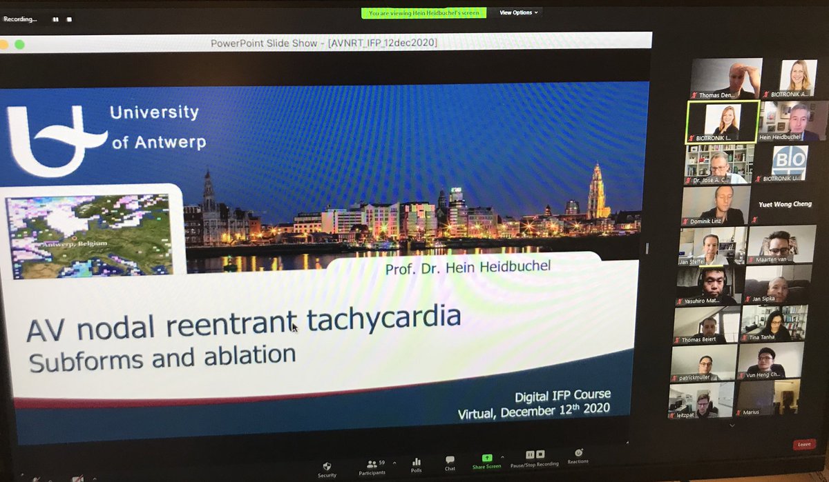 AnneNeubert1's tweet photo. 3/ Prof. Heidbuchel @HH4EHRA on what you have to know about #AVNRT & #EAT - From Differential Diagnosis to Electrograms and Ablation. #IFPdigital #pacebeforeablate https://t.co/Jubu0ZzoLE