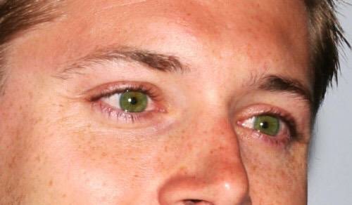 jensen ackles’ freckles, a cute thread