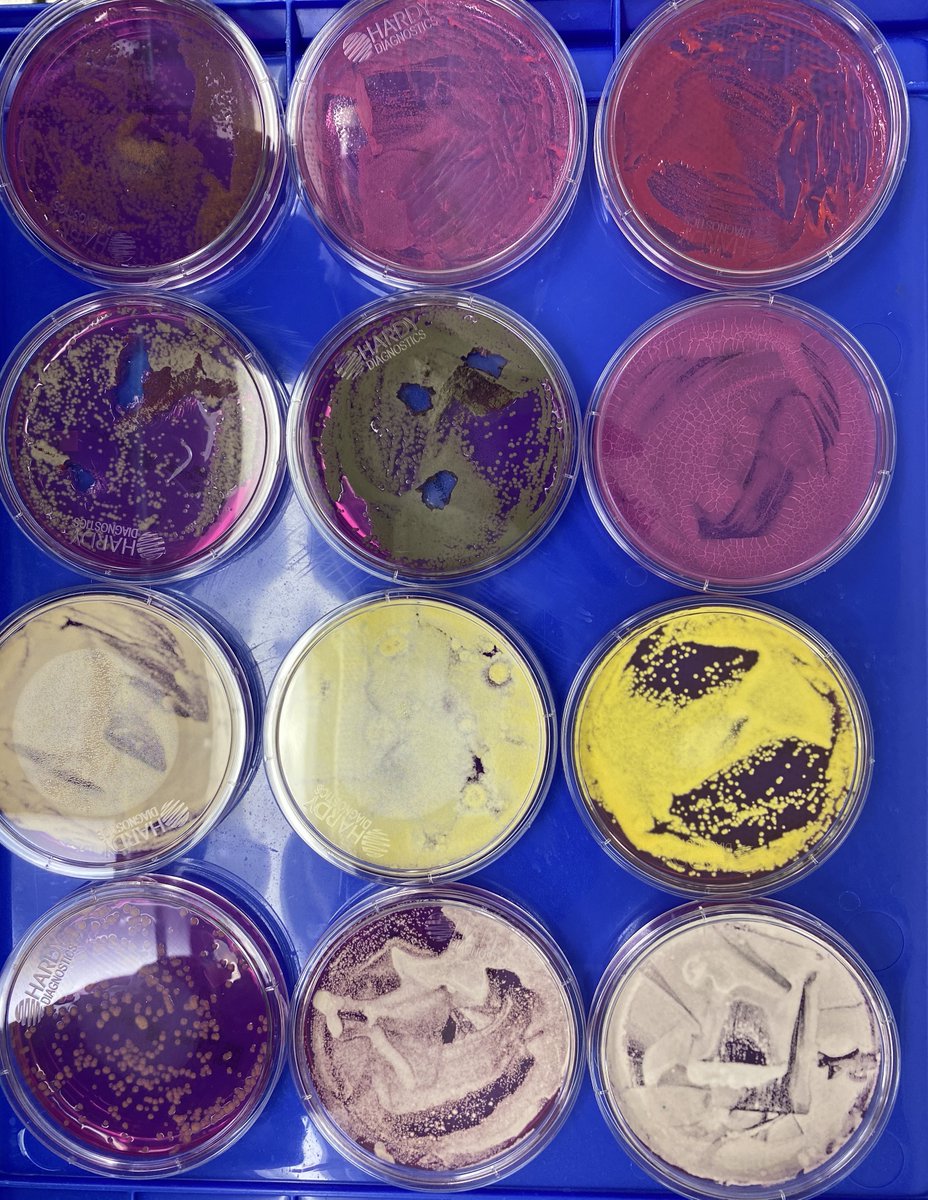 So unlike some people in the rush to make millions in qPCR testing off of C19, we first plate the microbes to understand the diversity of microbes we are dealing with and how many are viable. This is needed as the curing process kills some bacteria but not all the fungi.