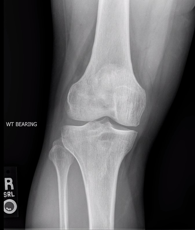 Orthobullets tweet media