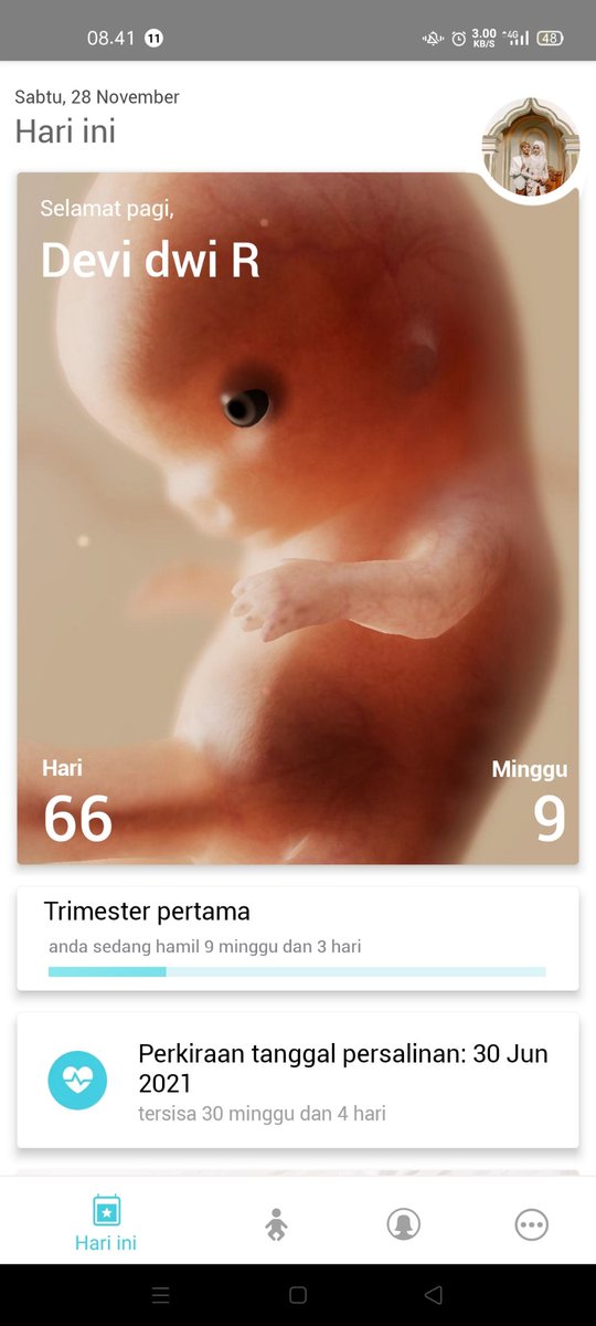 devii__d's tweet photo. Anak sholehnya ibuk,pangeran kecilnya ibuk.terimakasih sdh jd anak yg baik buat ibuk,terimakasih sdh hadir diperut ibuk
Maafkan ibuk yg gak pecut menjagamu.merawatmu.😥😭🙏
Sampai kpn pun ibuk akan sangat sayang ke km nak,sampai kapanpun akan tetap jadi ank ibuk https://t.co/Ce4JjDcmr5