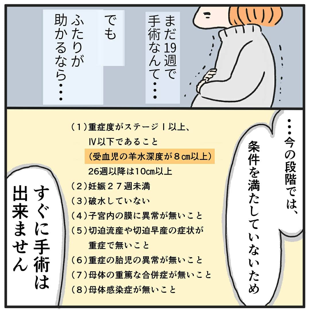 TTTS(双胎間輸血症候群)になった話(4) 