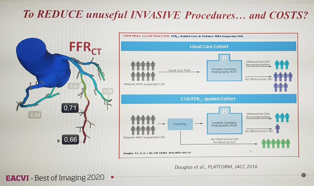  #EACVIBestof2020 I also found this interesting, the concept of the "non-useful" angio. Is an angiogram only useful if you find epicardial CAD? Remember just recently EAPCI published their position paper on Ischaemia with NOn-Obstructive Coronary Arteries (INOCA)...