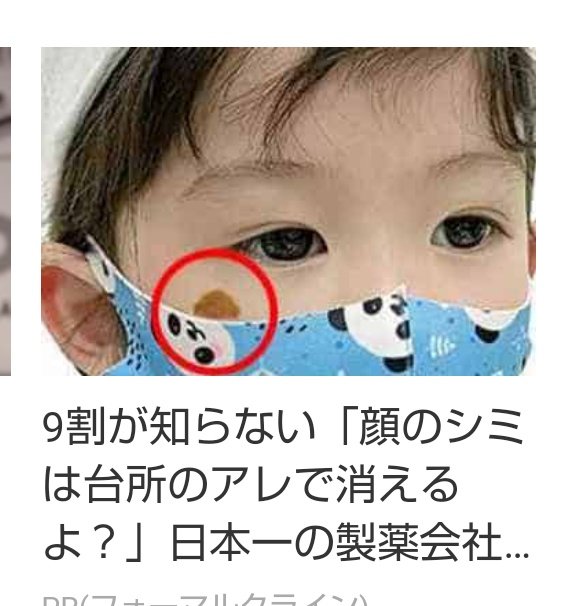 ヨウ 最近よく見るマスクのうちにシミどうにかしようprなんやけど この年齢の子にこのシミはさすがに無理がないか ヨウ 最近よく見るマスクのうちにシミどうにかしようprなんやけど この年齢の子にこのシミはさすがに無理がないか