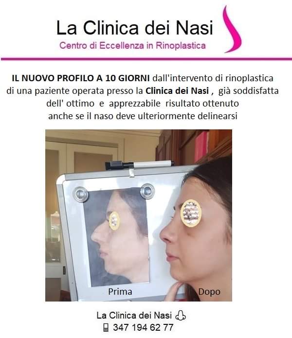 La Clinica Dei Nasi Clinicadeinasi Twitter