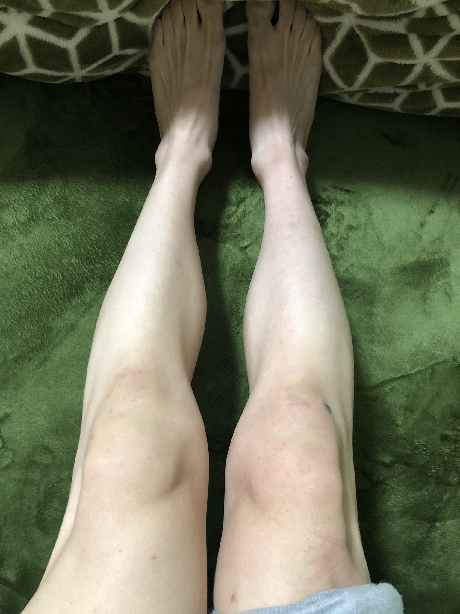 Sinno 暇過ぎて足の毛全部捨てたわ 自分の足がかわいくなって気持ち悪い笑 女の人の大変さが分かりました もうやらない 足の毛 除毛 T Co O8huzlngx3 Twitter