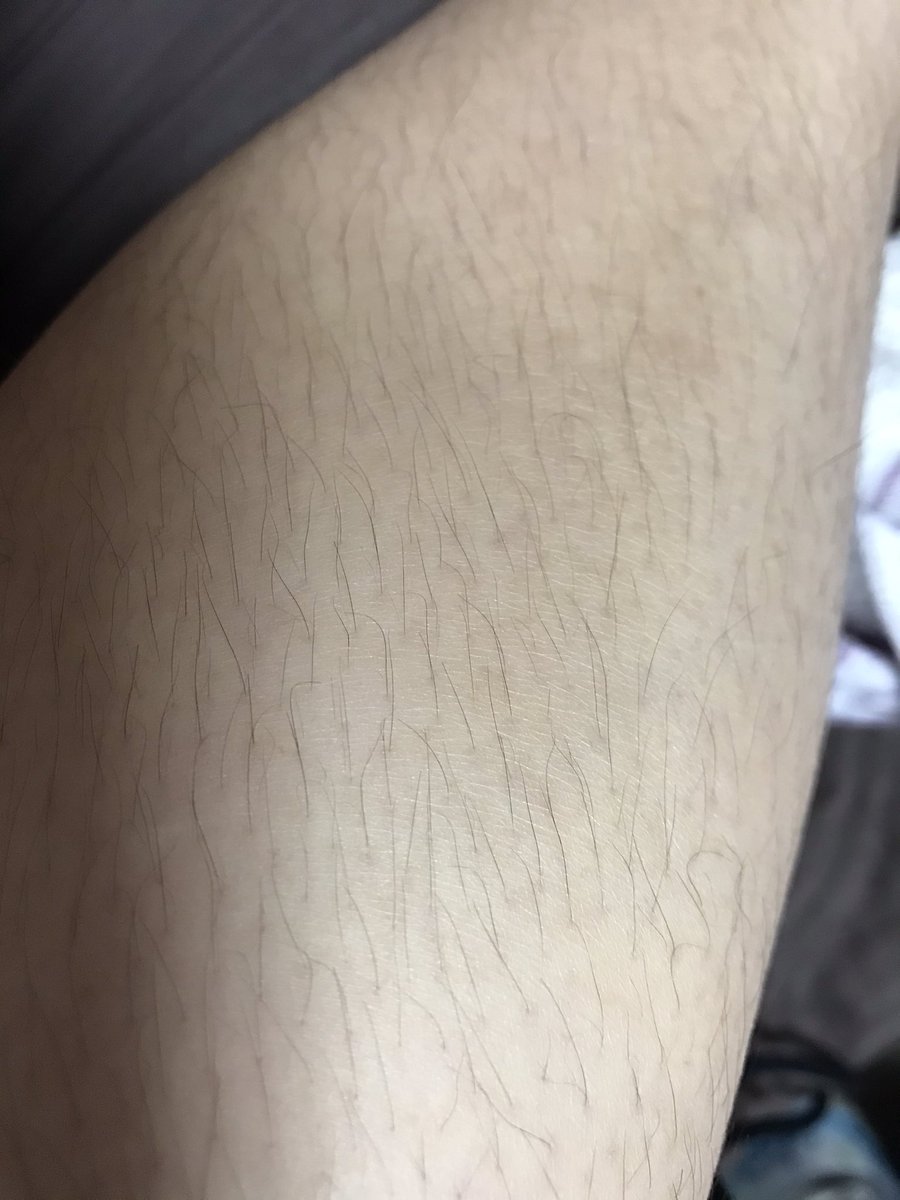 漆黒の闇 アイナナクラスタ 結構変わる いいね ドンキで買ったの結構使える 残しとか太ももとかはしてないけど全身使うなら1本使っちゃうかもだけどいい感じ 今のところ肌も荒れてない サラーリタッチ 除毛クリーム ドン キホーテ これが こう