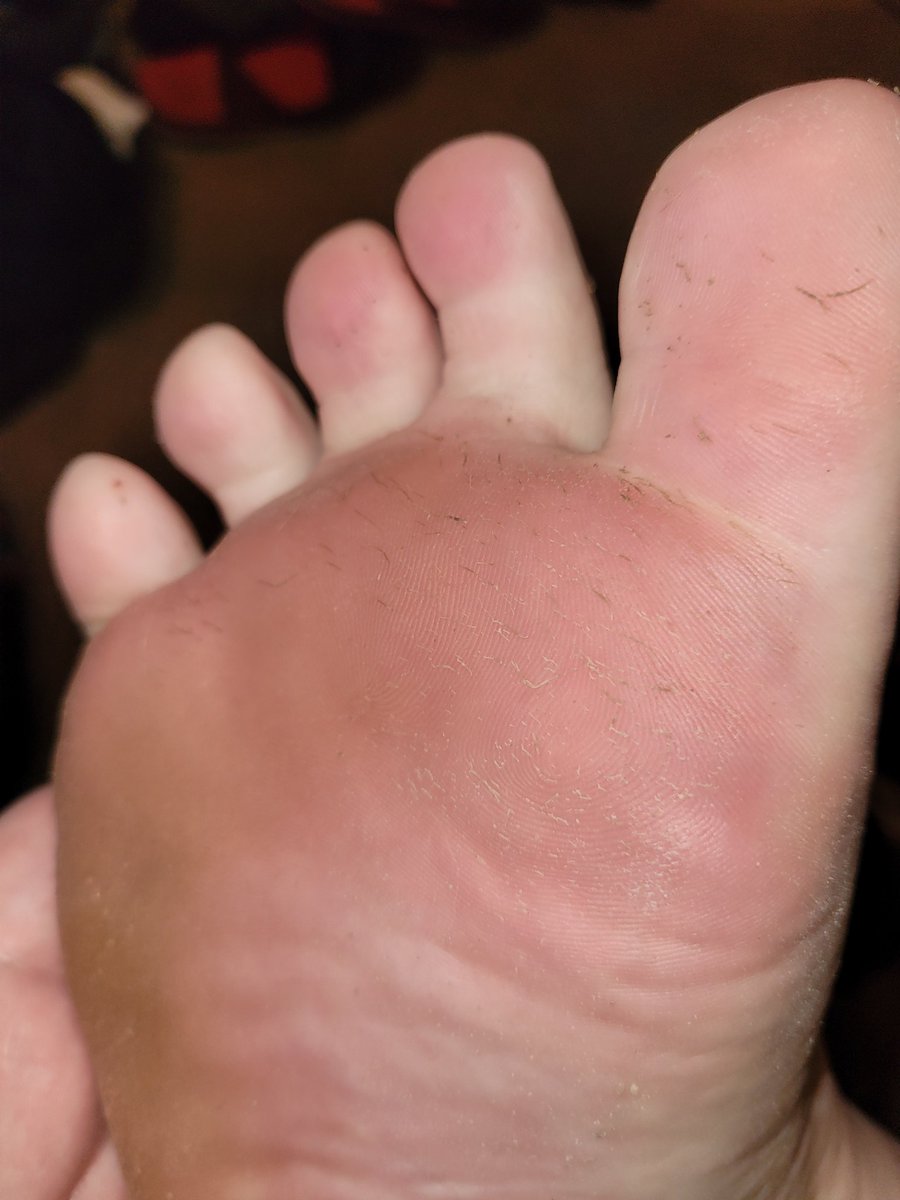 mistertoejam's tweet photo. More stinky feet from the other day! It would feel good to have these worshiped!! #footfetish #feetfetish #malefeet #malefootfetish #guyfeet #guyfootfetish #manfeet #stinkyfeet #sweatyfeet #dirtyfeet #alphafeet #footstink #footworship #soles #footfunk #footmaster #footgod https://t.co/gZ2OTv2pyJ
