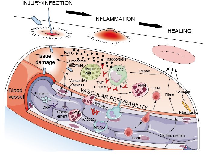 Inflammation is a response to cell damage which can be caused by infection, autoimmune response, cancer & trauma.So any of these might affect the numerous inflammatory markers found in our blood. These include CRP, ESR and plasma viscosity.