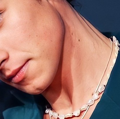 Shawn Mendes' jaw and neck: a necessary thread