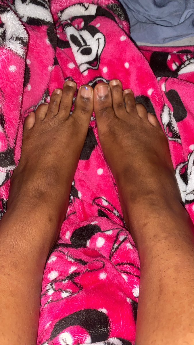 QueenAmFindom's tweet photo. Baby feet and childhood scars 😏 https://t.co/jxs0r9GuB0