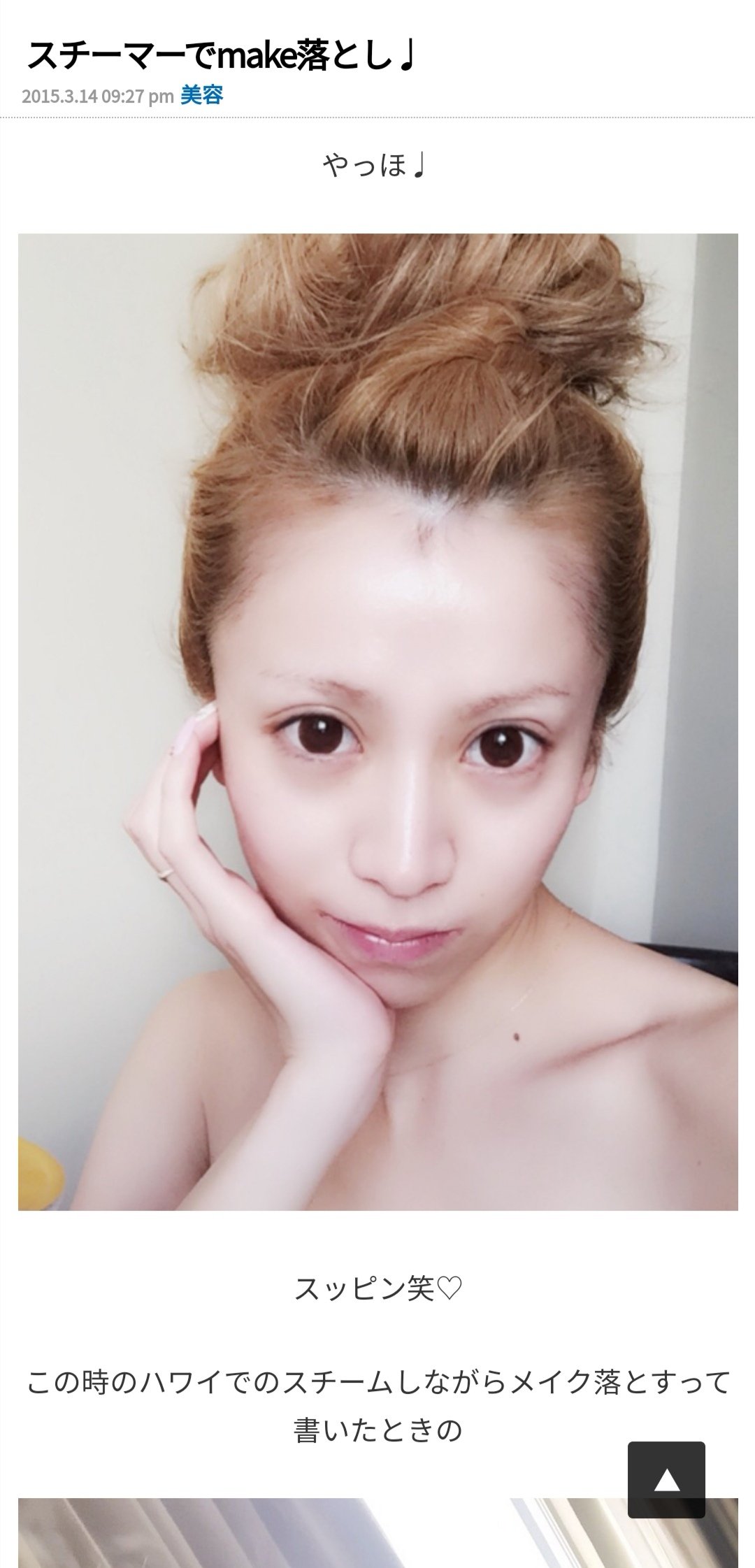 Twitter 上的 末原りか 美容ナース社長 愛沢えみりちゃんの顔面が死ぬほど好きなんだけど 二重幅修正 鼻の整形が大成功すぎる ついでにアートメイクと裸眼で垢抜けて 目の下の脂肪取りで 疲れ顔が改善されたのも素晴らしい ゼオと定期ハイフでメンテもしてるし