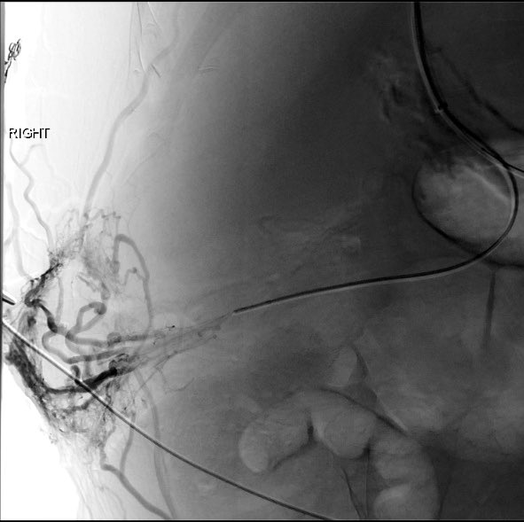 Albany IR tweet media