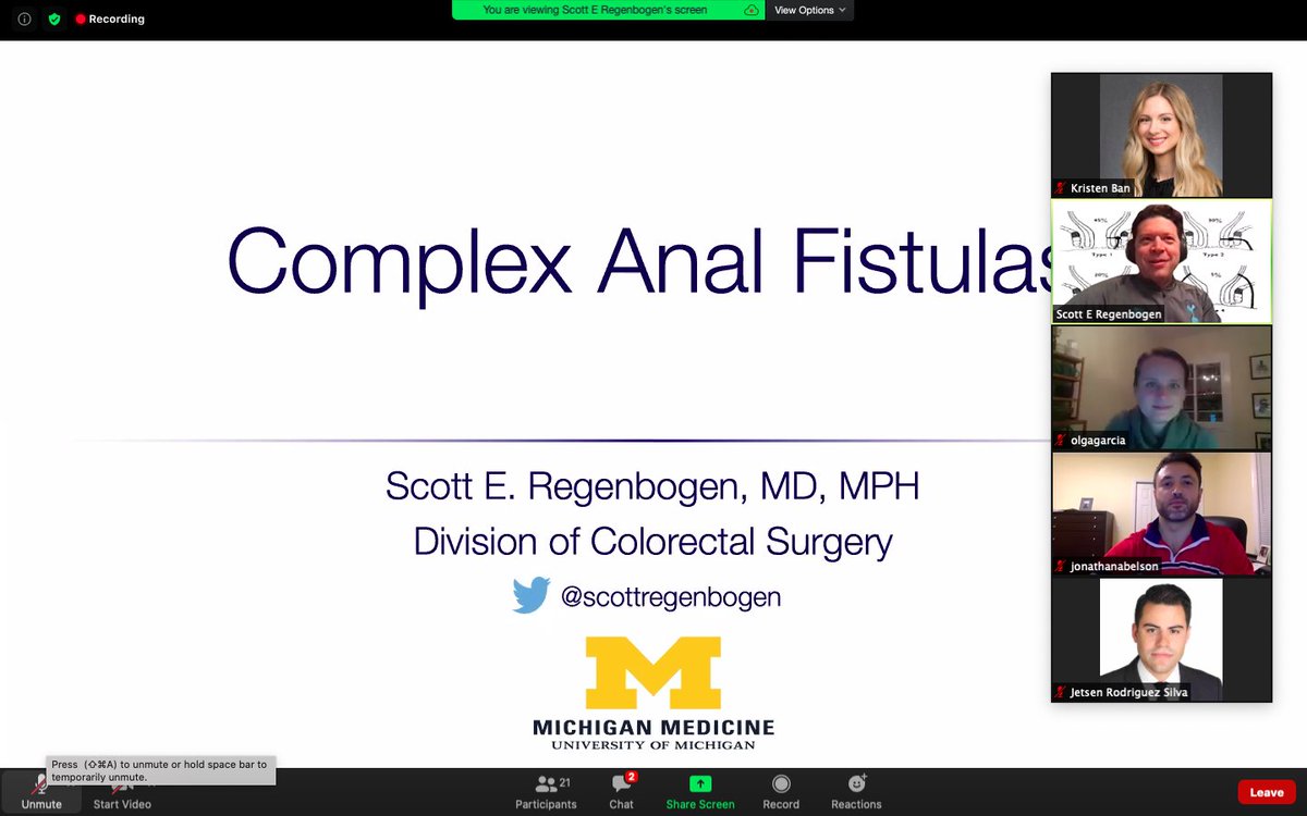 KristenBanMD's tweet photo. Thank you @scottregenbogen for tackling a tough topic for #CRVirtualEd!
Takeaways:
โก๏ธ Advancement flap vs LIFT for complex fistulas
โก๏ธ Diversion for complex Crohn's perianal disease usually permanent, counsel accordingly
โก๏ธ Stay tuned: stem cells @AmyLightnerMD https://t.co/DMBjvTxpoG