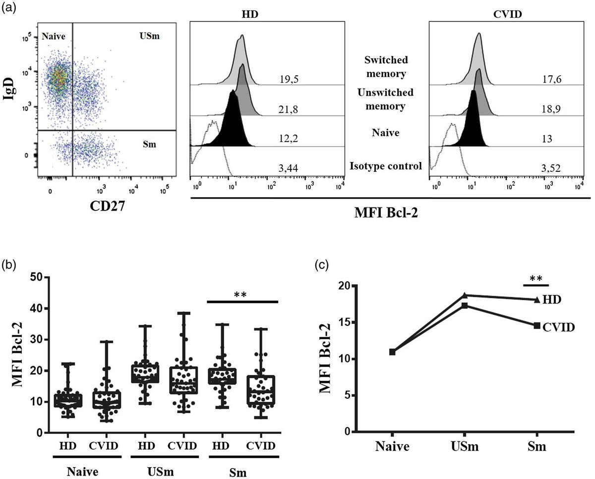 CEIjournal's tweet photo. Defective Bcl‐2 expression in memory B cells from #CommonVariableImmunodeficiency patients
@elopezgranados & colleagues at @CIBERER & @IdipazScience investigate roles of intracellular signalling defects in B cell differentiation, survival & activation
(£)https://t.co/YeISgEwfAn https://t.co/n0mrFYv5l7
