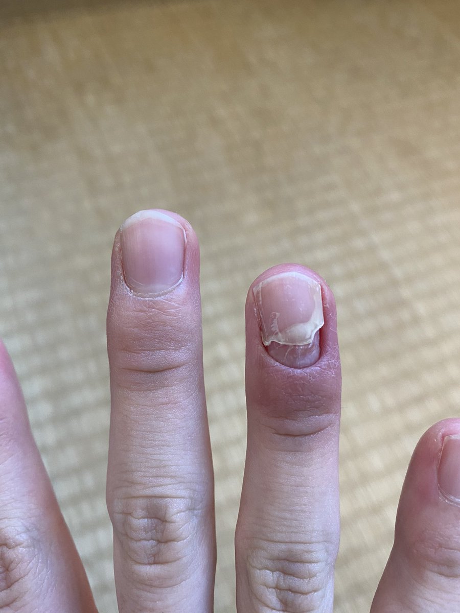 ジヤモウ Osinokasiramoji Twitter