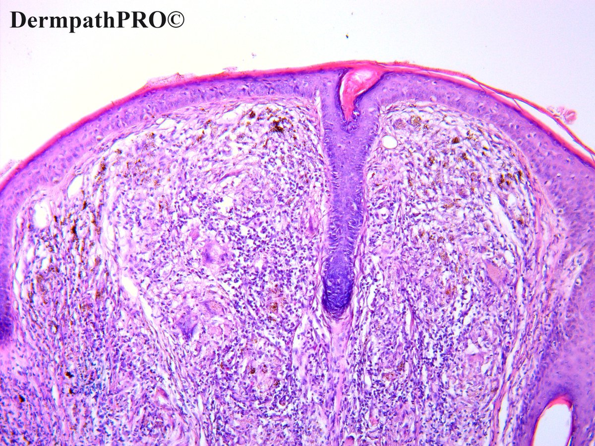 DermpathPRO tweet media