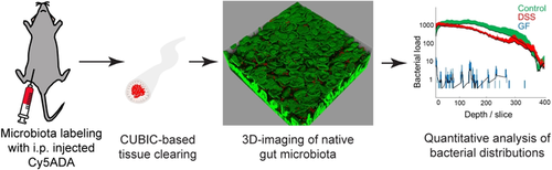 angew_chem's tweet photo. Three-Dimensional Quantitative Imaging of Native Microbiota Distribution in the Gut (Shao) https://t.co/SwD6f1hvOk https://t.co/6MqiwaDoMe