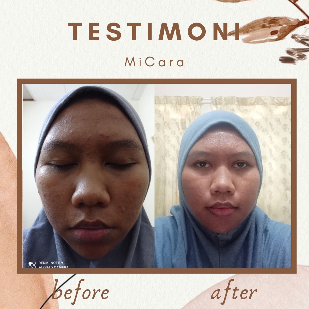 micaraherbs's tweet photo. Hello guys.. i nak tanya siapa ada masalah skin?
.
Macam masalah resdung, berminyak, sensitif skin or masalah lain pun boleh tau! Korang boleh try Herbs Soap Cleanser ni, sebab 100% dibuat dari bahan natural 🌱 &amp; homemade 💕 
☘️ We got so many testimoni and feedback.. 
THREAD 👇🏻 https://t.co/Uivs3DRRVD